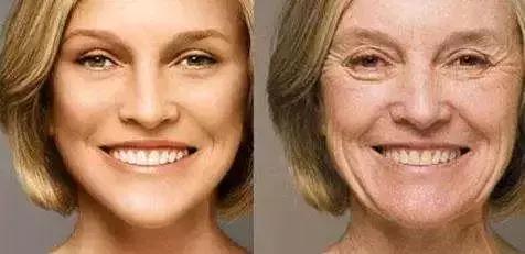 线雕5年后的变化图片,做了线雕以后的注意事项