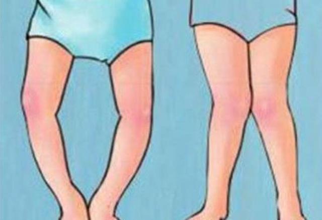 腿弯感觉无力是什么原因造成的,腿型弯是什么造成的