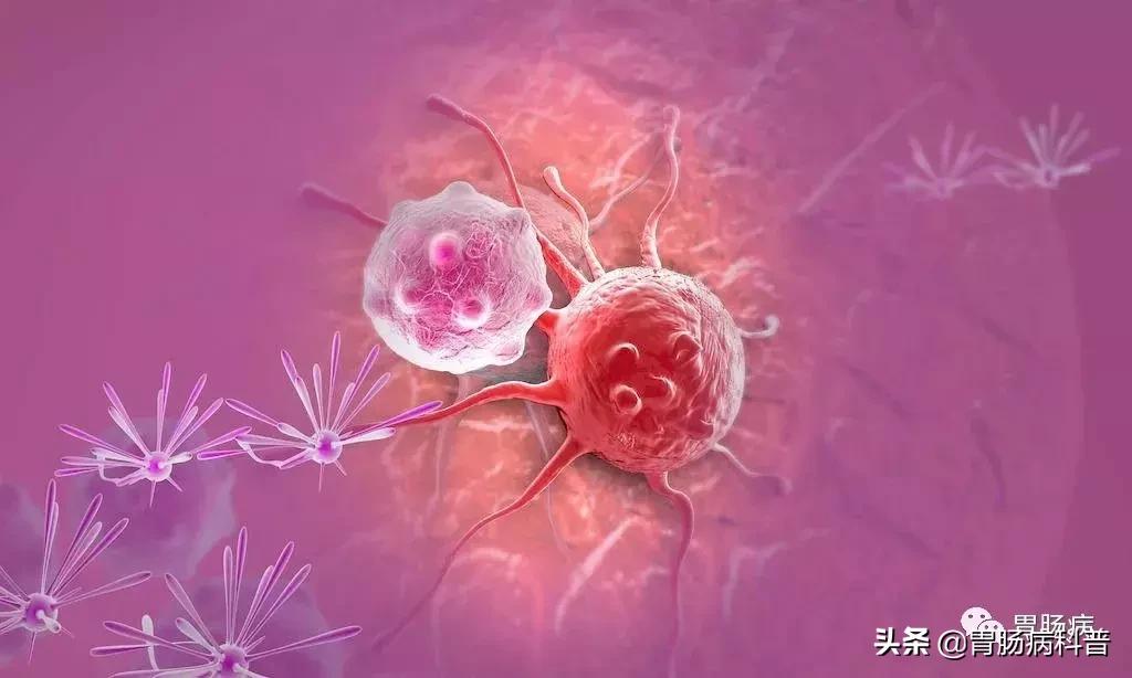 上皮内瘤变、不典型增生、异型增生...这些究竟是不是癌？