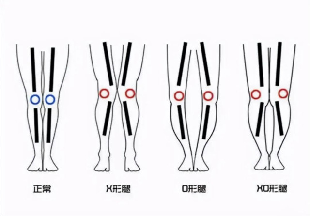 长筒靴和短靴的区别,长筒靴和短靴哪个显高级
