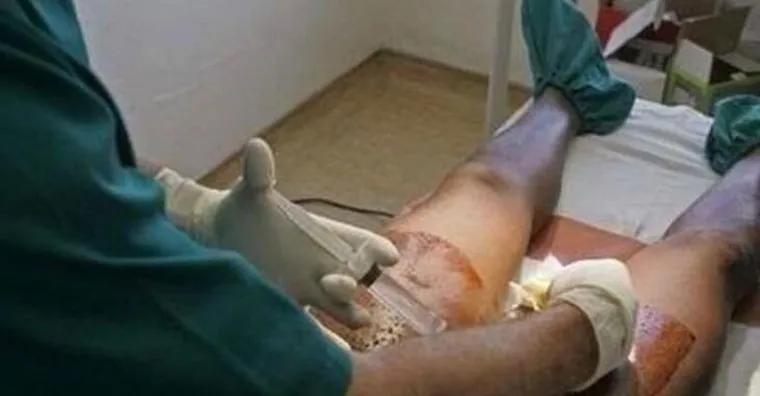 大吃一惊！一女子用“土豆”避孕，结果悲剧了！医生：合理避孕