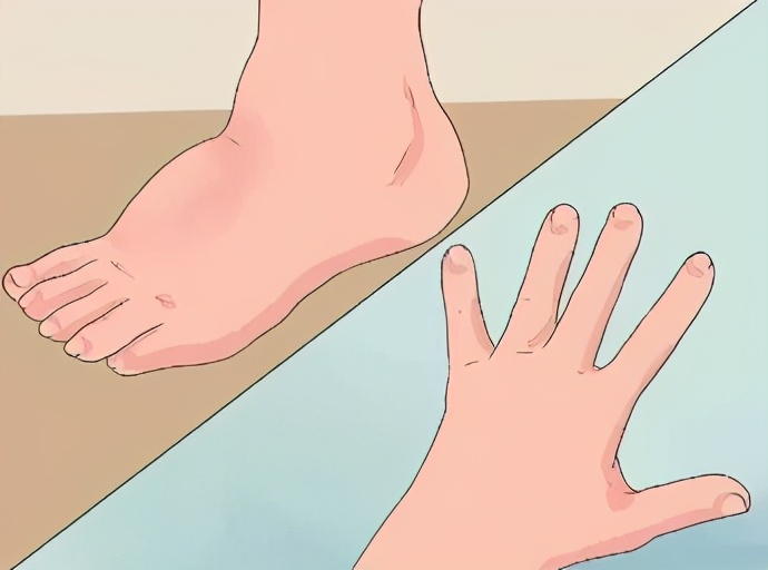 孕妇瑜伽缓解孕期不适,怎样缓解孕期胃部不适