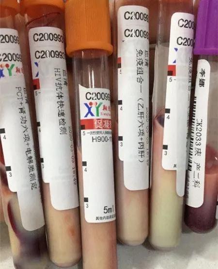 奇迹！从”死神“手中拽回的高危产妇