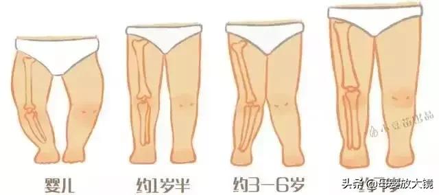 宝宝腿型不直是什么原因引起的,新生儿宝宝腿不直怎么纠正腿型