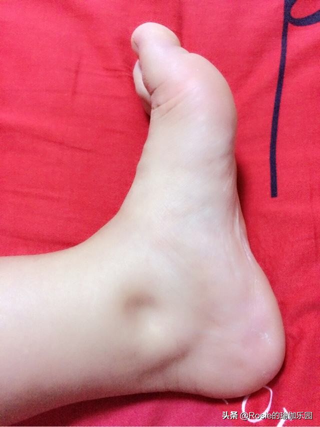 双腿粗最有效方法,腿粗如何凸显脚踝