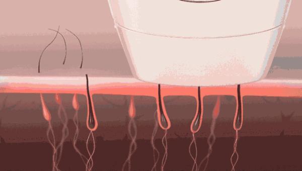 人类脱毛是为什么,人类脱毛期