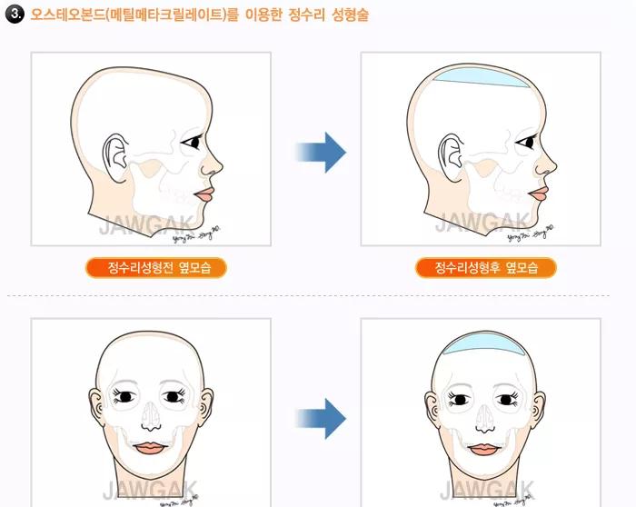 吉娜的腰是怎么瘦的,吉娜胸大腰细为什么不显胖