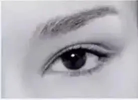 怎么知道自己最适合哪种双眼皮,双眼皮有哪几种类型图片