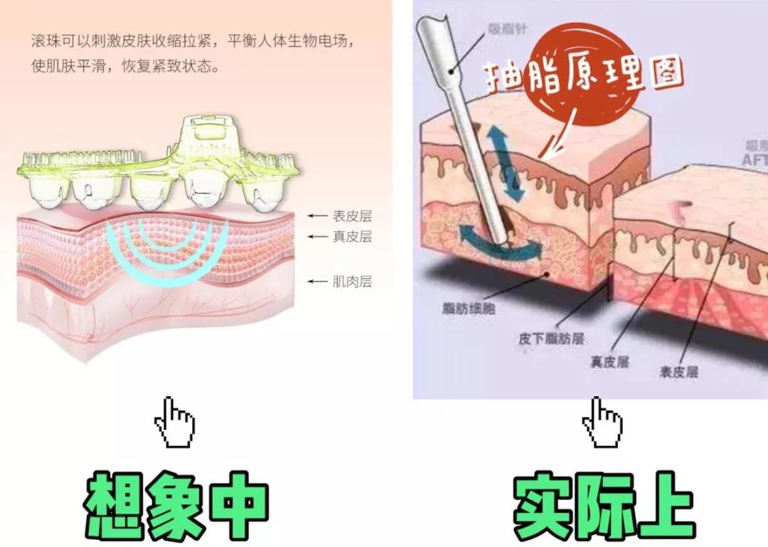 超管用的瘦腿办法靠谱,真实有效的瘦腿产品