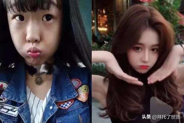 石原里美和佐藤健,石原里美整容之路