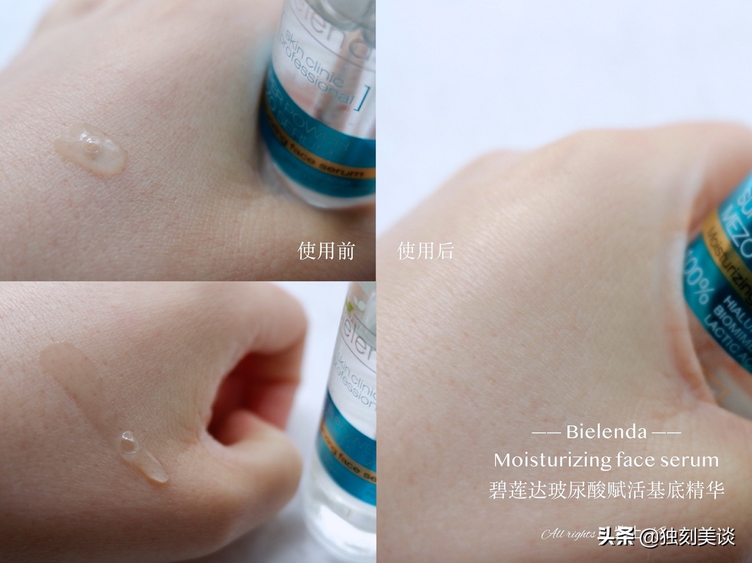 最好的玻尿酸精华是什么,玻尿酸精华值得买吗