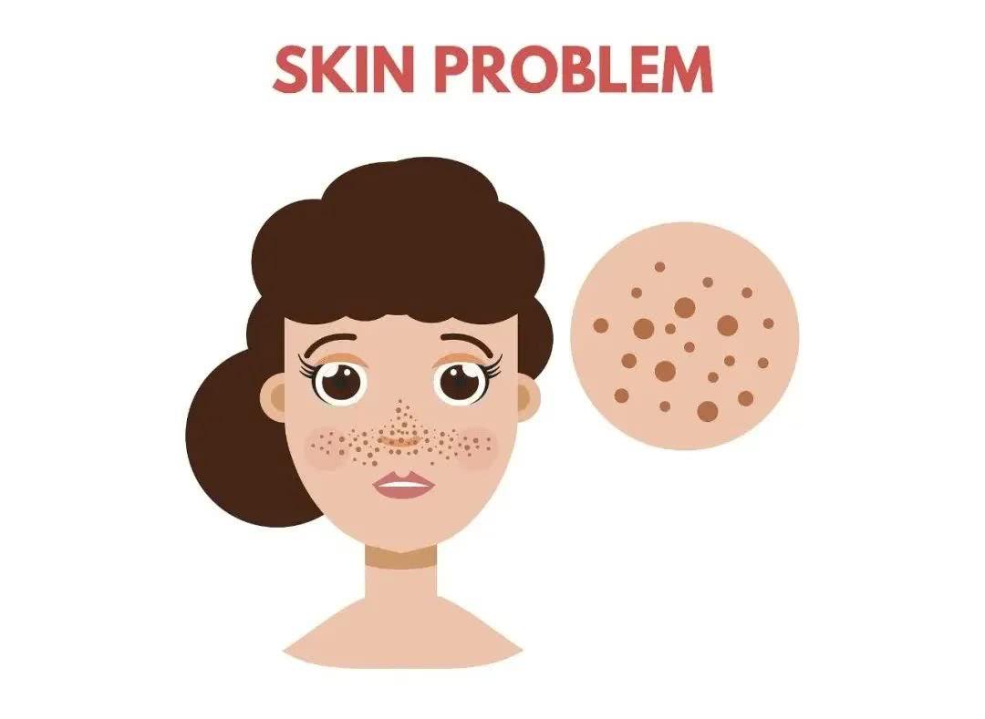 褐黄病是什么原因引起的,褐青色斑产生的原因