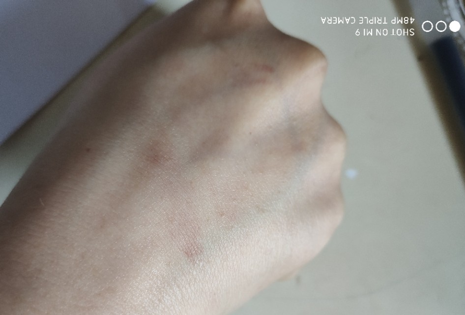 蓓昂斯卸妆水和贝德玛哪个好,西班牙蓓昂斯卸妆水真的假的