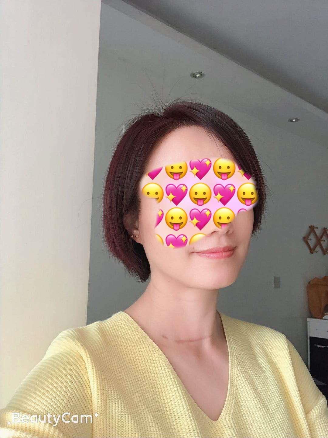 教师容易得甲状腺病吗,甲状腺是老师的职业病吗