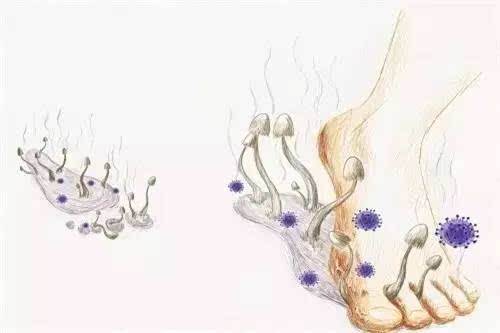 脚底有一个部位瘙痒是什么原因,脚底痒要警惕四种病
