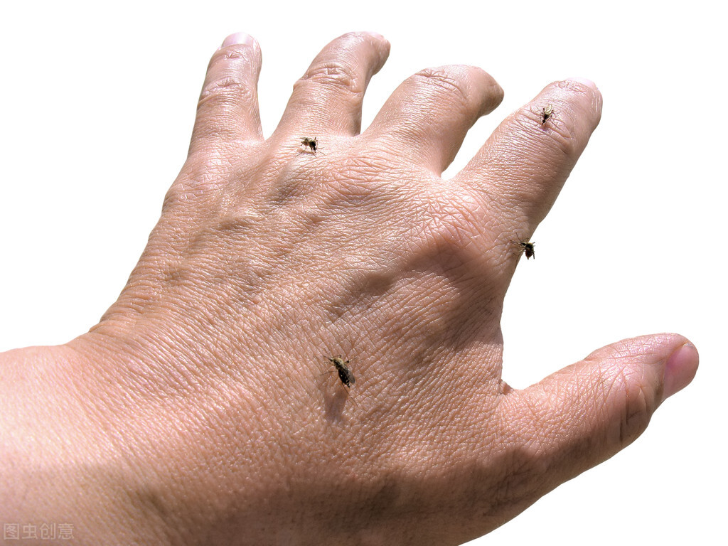 移友请注意！小外伤也容易引发*麻大**烦，处理措施getup