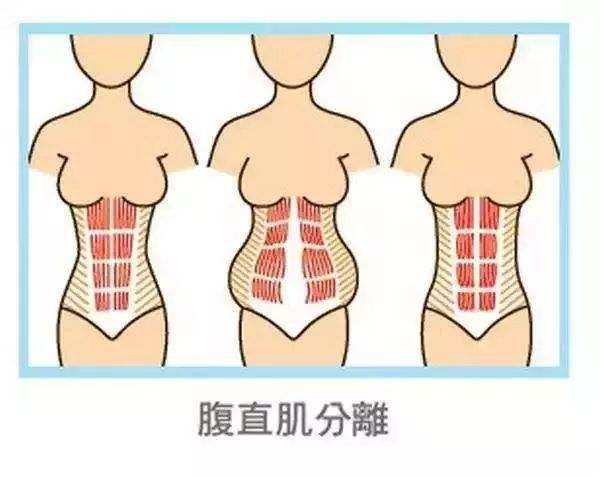 李湘现在是瘦了还是胖了,李湘瘦回巅峰