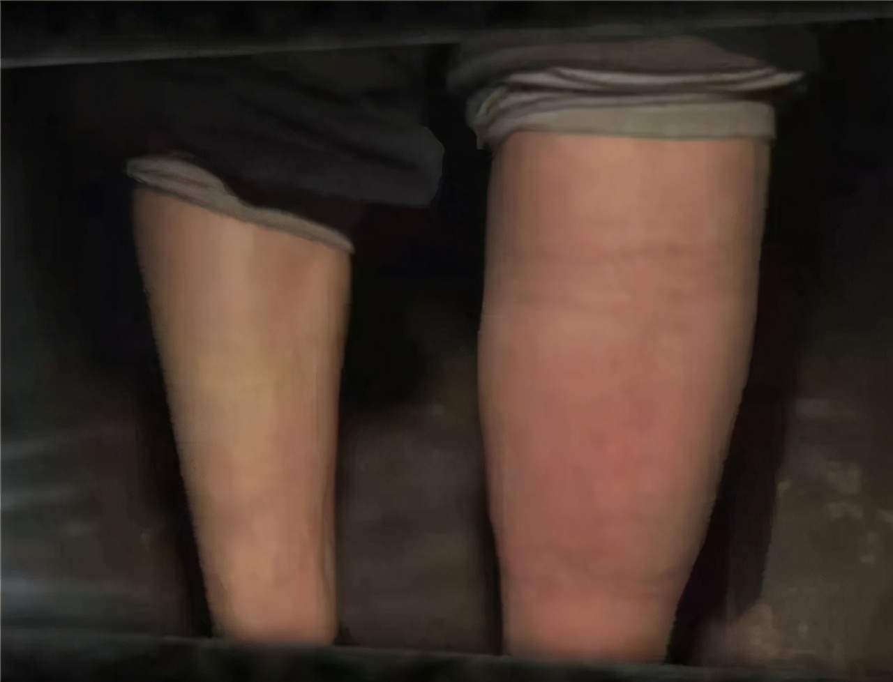 傻医生视频大全,傻医生秦均天