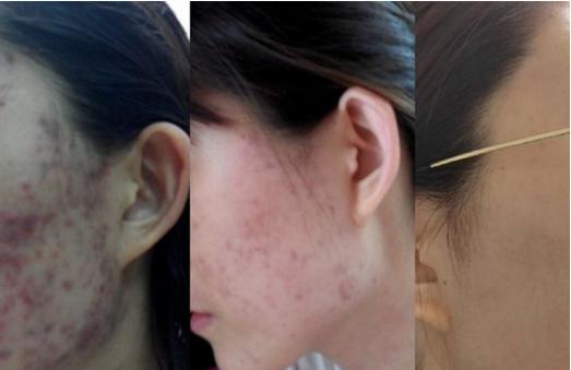 每个月花1000化妆品比不上医美吗？整形医生告诉你事实真相