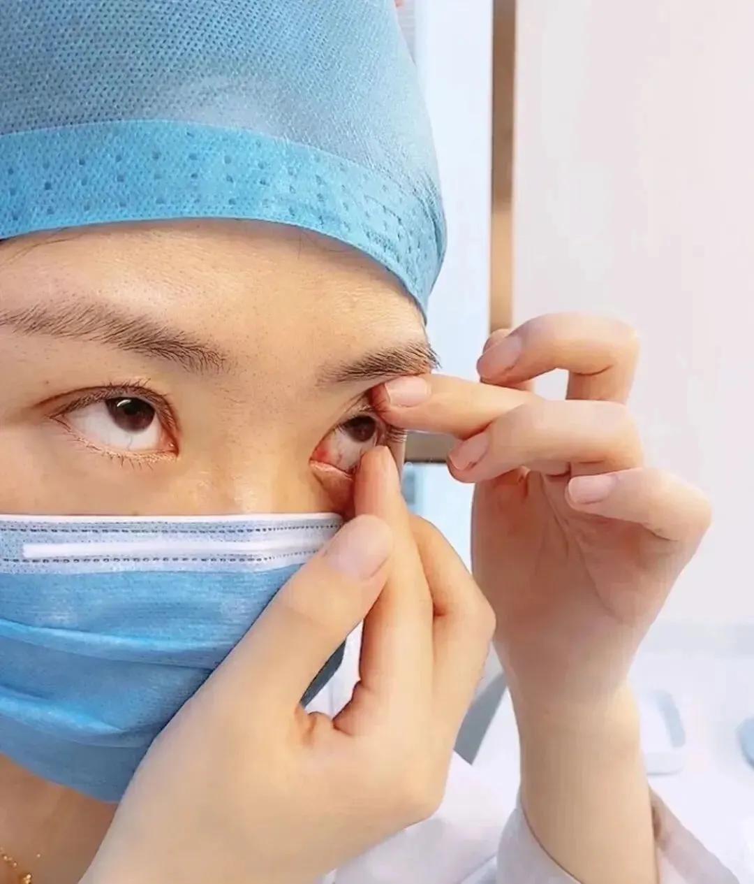 隐形眼镜怎么摘新手,隐形眼镜怎么摘眼睛才不疼