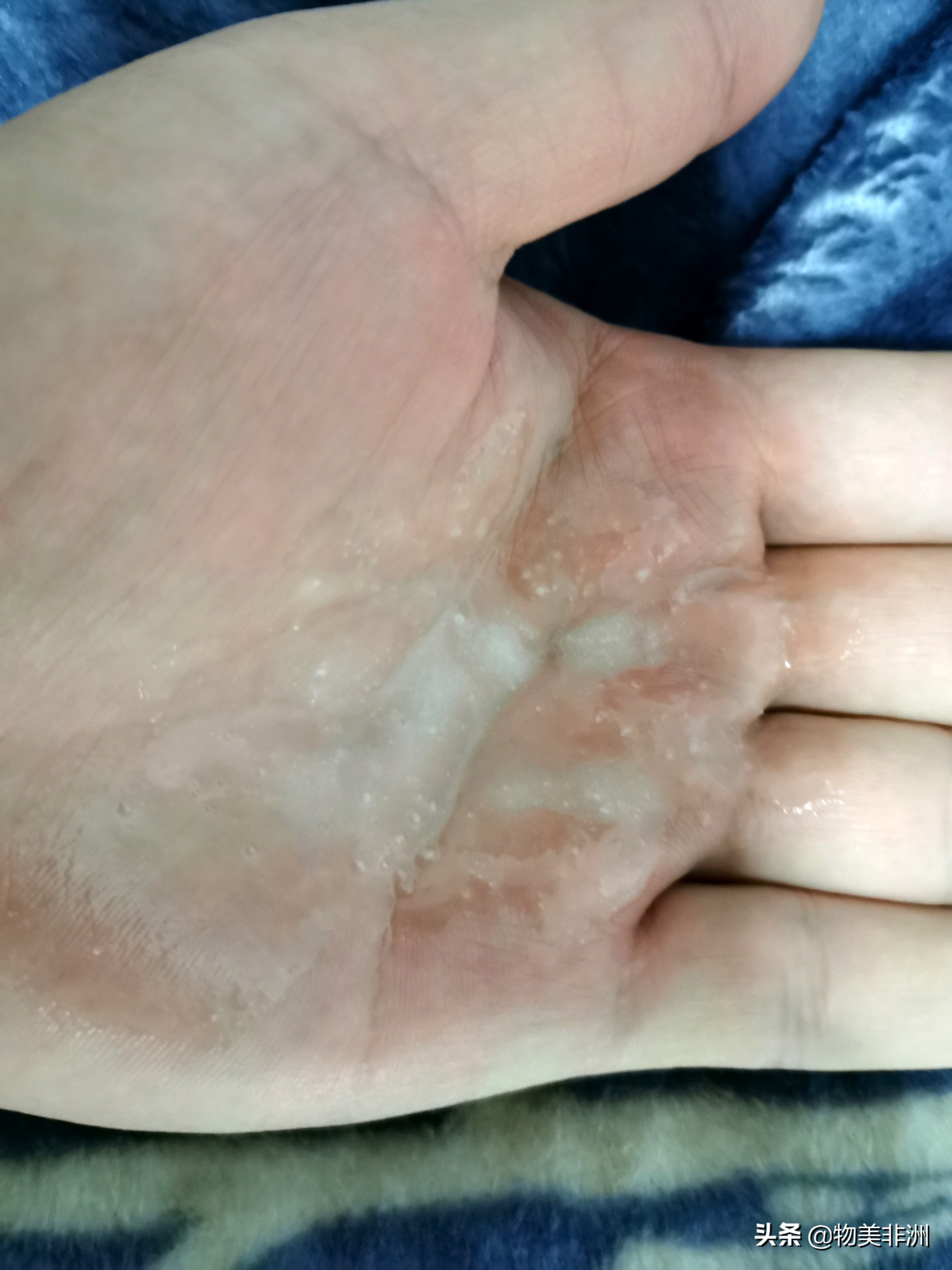 干燥的冬季怎么保湿皮肤,北方的冬天要怎么面部保湿