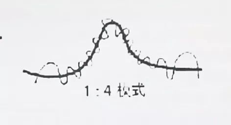 剖宫产和顺产哪个更痛,顺产和剖宫产哪个更痛