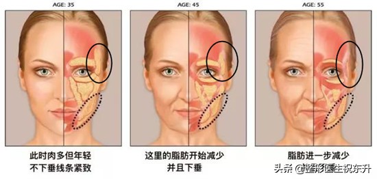 太阳穴凹陷与额头有明显棱角面相,太阳穴凹陷的脸型有长的好看的吗