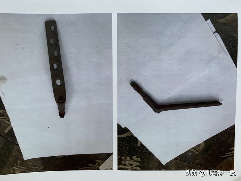 商丘79岁老人骨科手术后去世,老人骨科手术