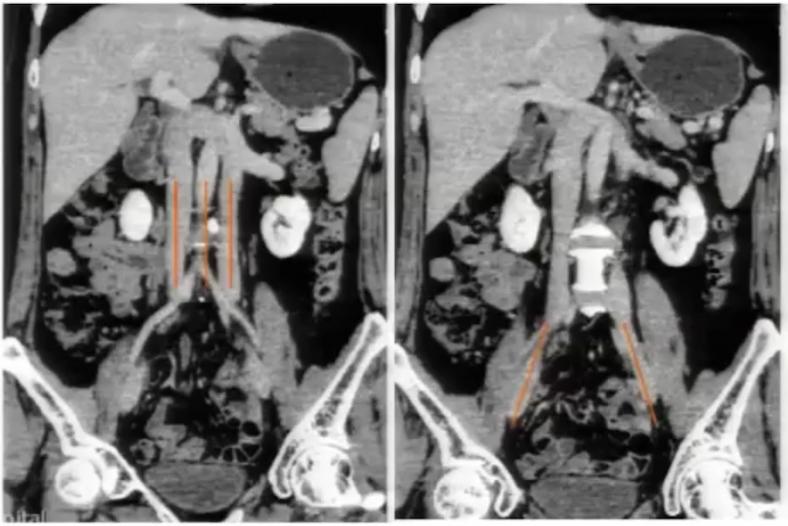 腹部ct详细讲解,腹部ct示意图及超详细教学