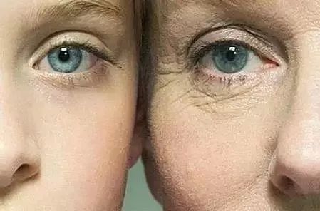 去除鱼尾纹抬头纹法令纹打什么针,有鱼尾纹和法令纹适合做什么医美