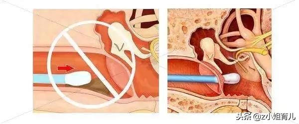 家长可以给小孩挖耳朵吗,宝宝耳朵能挖耳屎吗