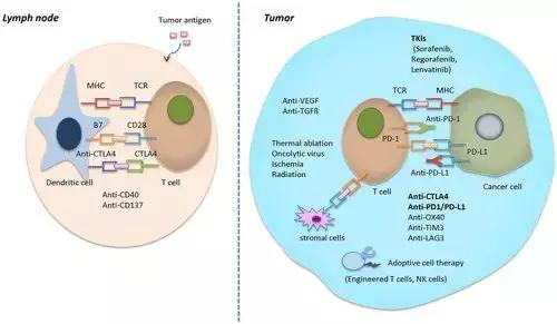 肝癌联合免疫治疗是什么意思,肝癌免疫治疗方法最新进展