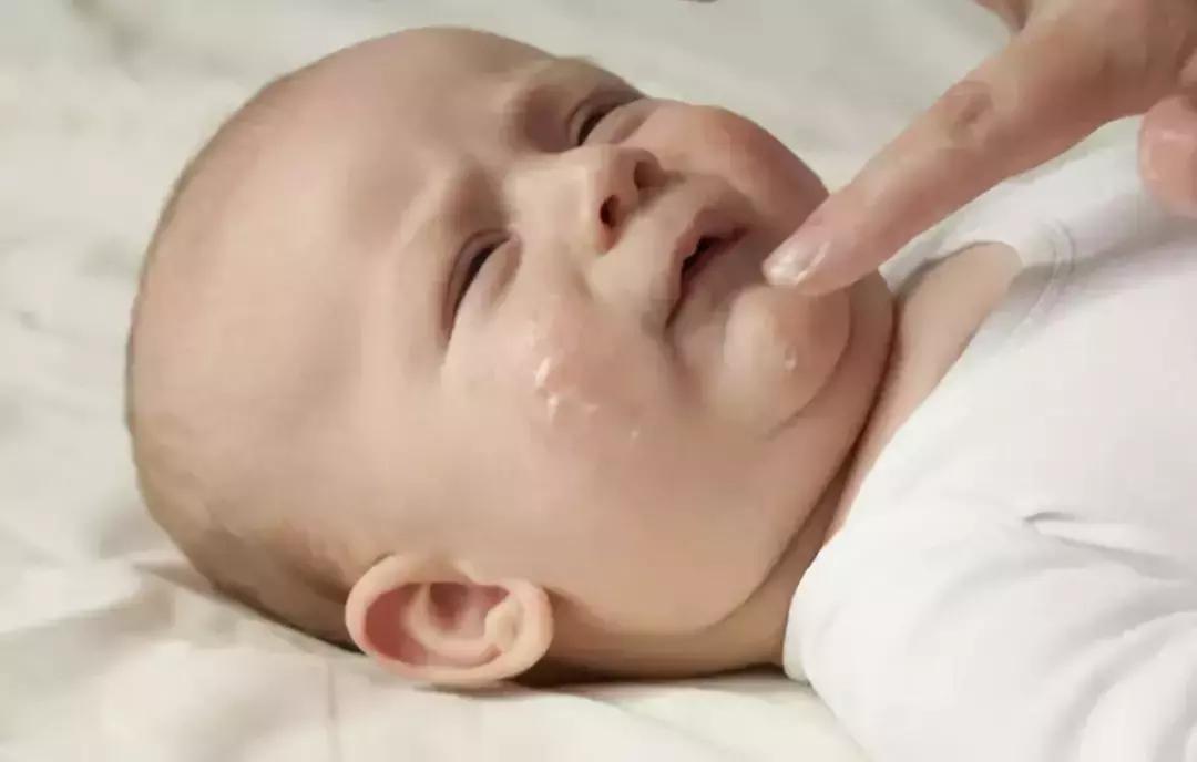 适合湿疹患者的护手霜,湿疹止痒护手霜