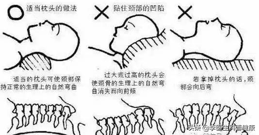 经常头晕要小心是颈椎病？颈椎病的7大缓解方法，很管用！