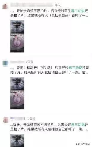 16位牙医自曝内幕看牙警惕哪些,牙医看牙时在想什么