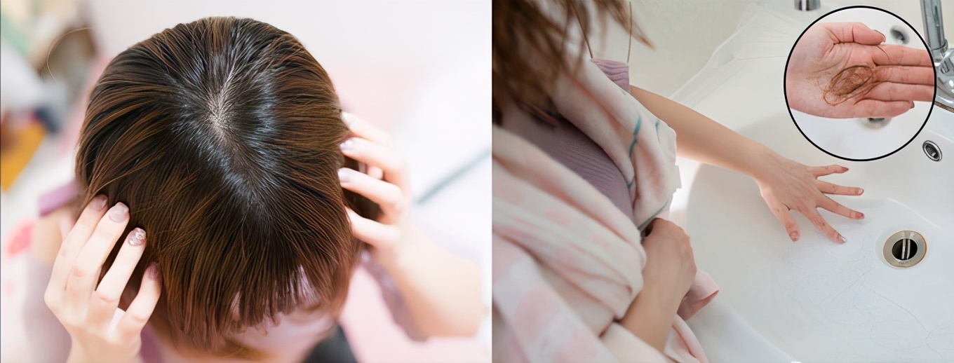 真正防脱固发的洗发水,最好用的防脱固发洗发水