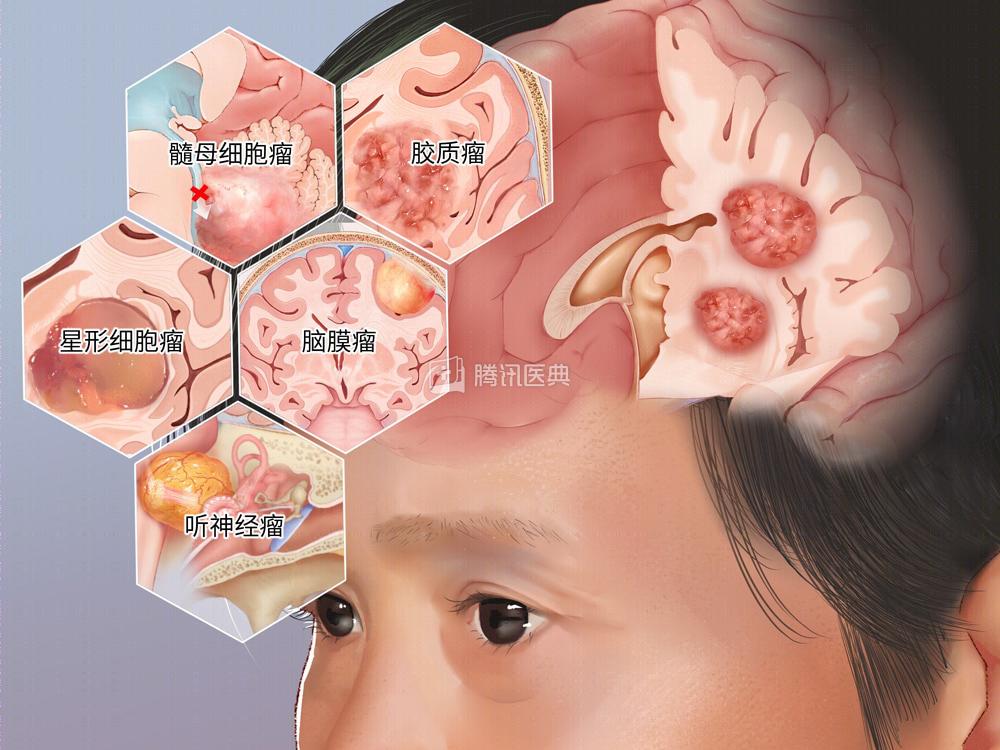 深圳癌症发病率最高的城市,深圳癌症多少例