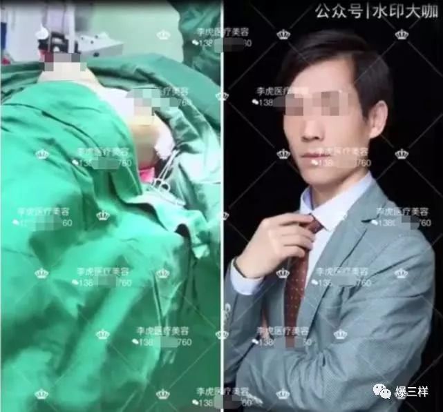 临沂美容曝光事件,临沂大型美容医院