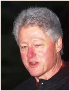 去黑头甲硝唑凝胶的图片,甲硝唑凝胶去黑头正品