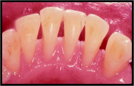 狗狗洗牙的良心忠告,医生忠告千万别洗牙