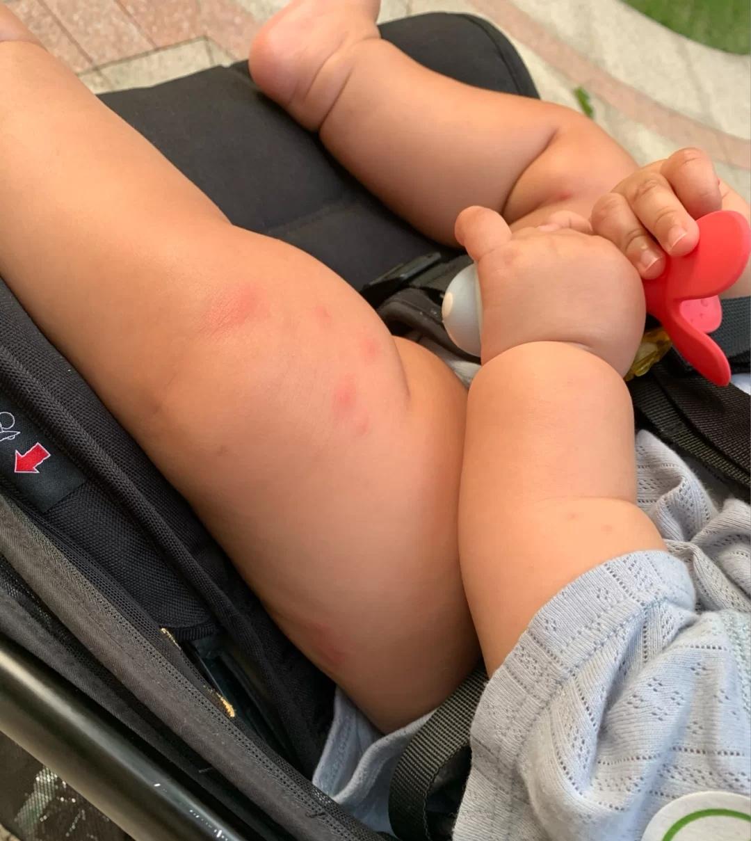 宝宝有蚊子咬搞什么驱蚊,宝宝总被蚊子咬怎么有效驱蚊