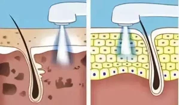 祛痘印最有效的方法,有什么祛痘印最有效的方法