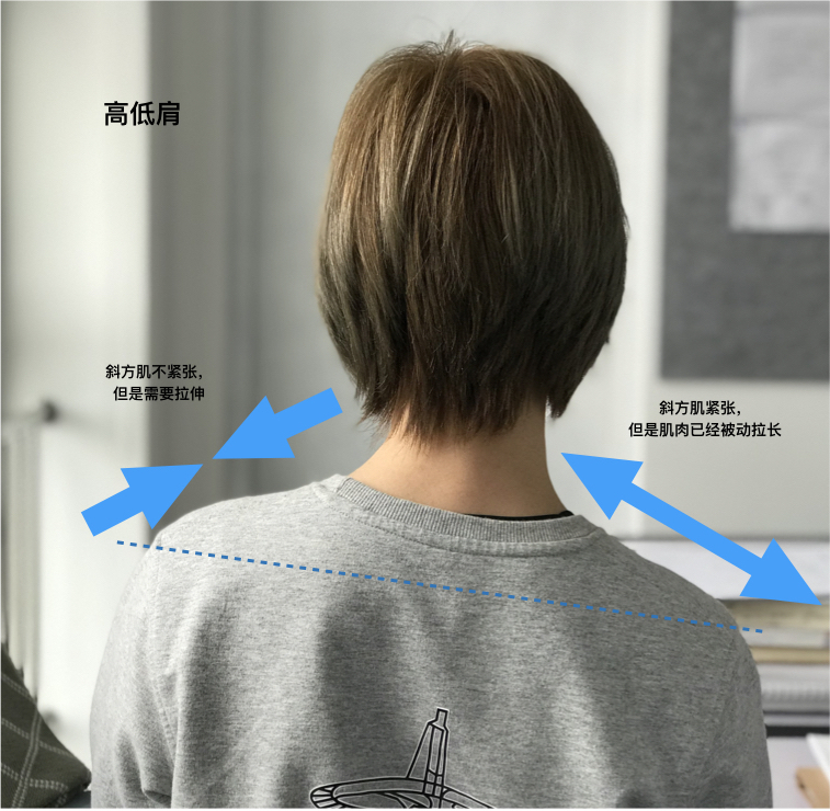 中年女士颈椎锻炼,颈椎病怎么健身