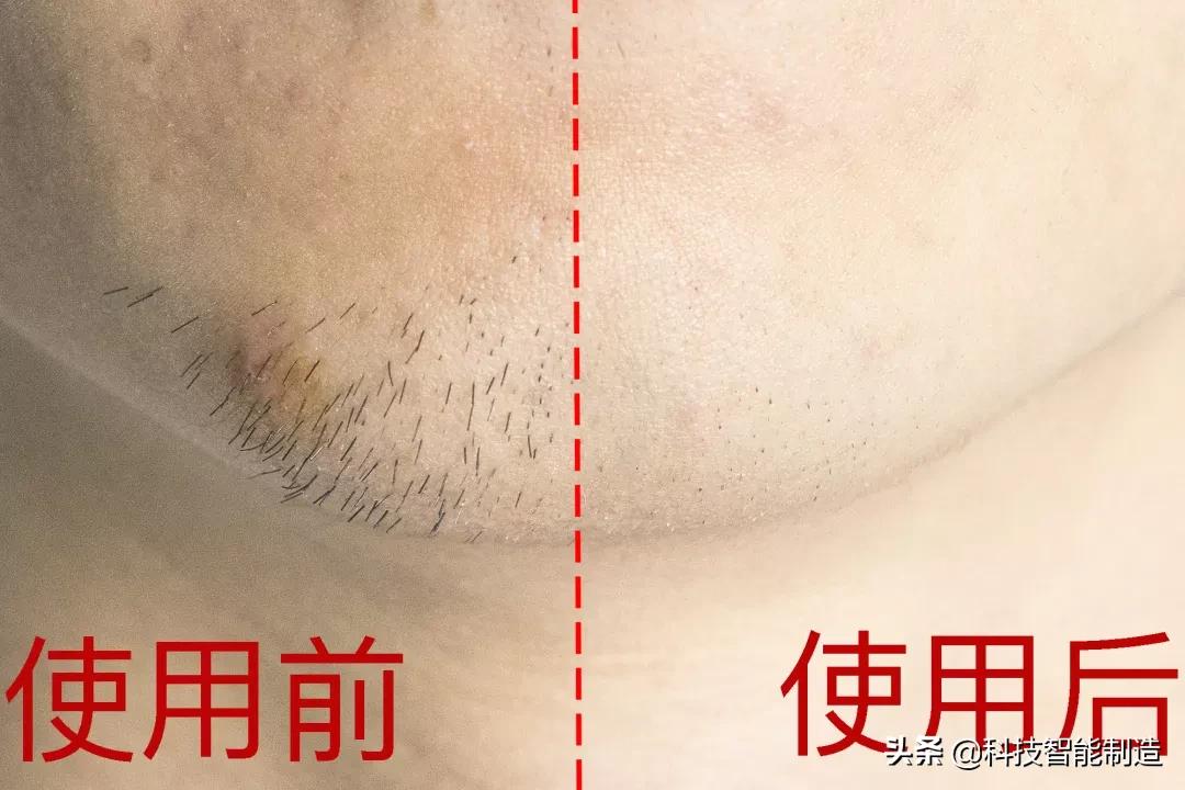 小米最好用的一款剃须刀 (小米电动剃须刀s300与s500哪个好)