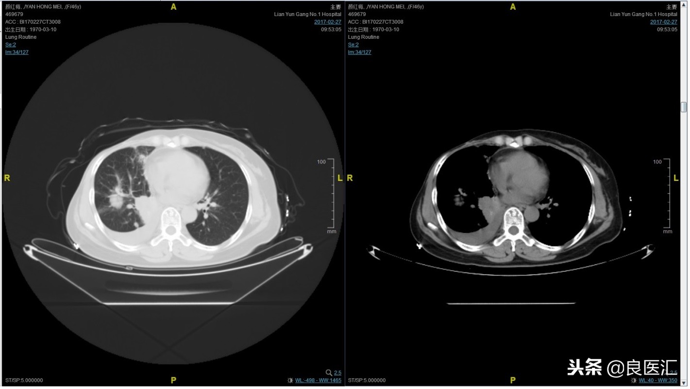 美图秀秀成功案例,美图秀秀实战案例