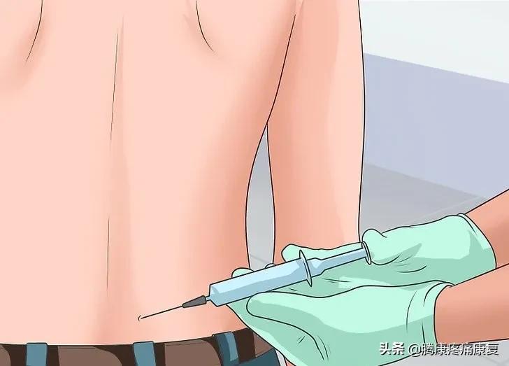 骶髂关节疼痛一招解决,缓解骶髂关节疼痛的六个训练动作