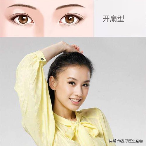 关于双眼皮你应该知道的有哪些,做双眼皮必须知道的三件事