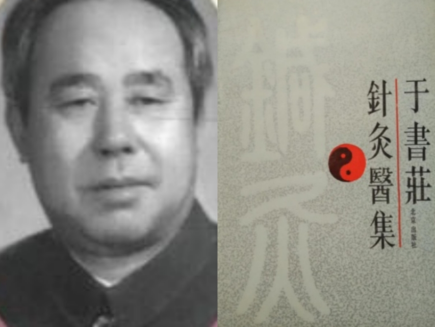 北京于书庄针刺风池合谷太冲头维并太阳放血治血管扩张性头痛案