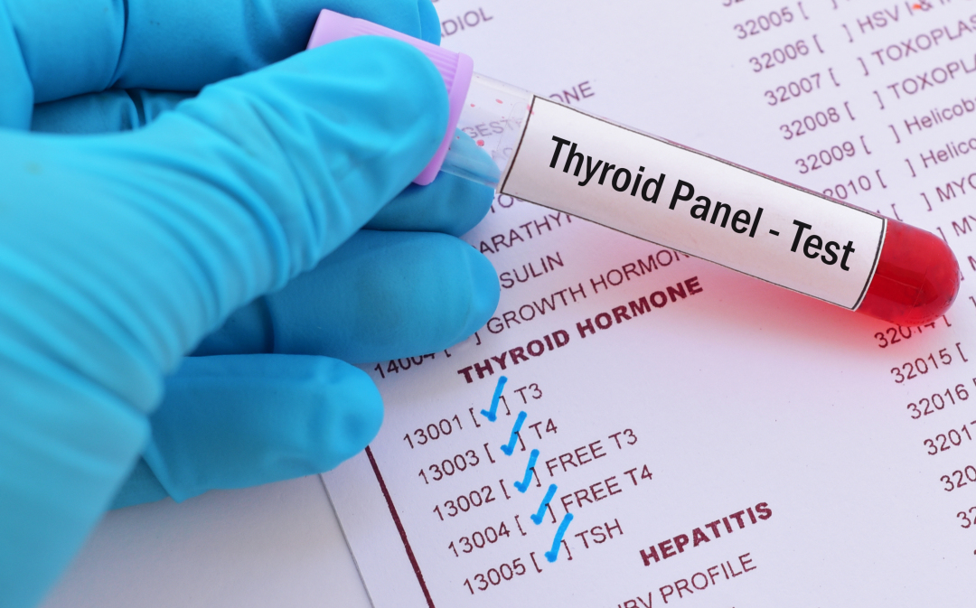 孕期甲减吃中药还是补激素,孕期甲减需要补铁吗