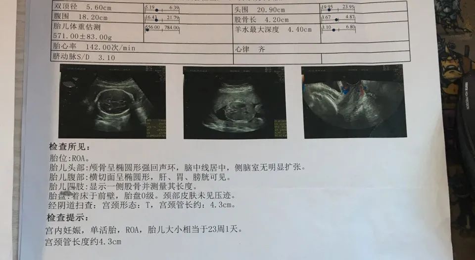 孕期复查胎儿侧脑室宽做什么b超,孕期一般做几个b超